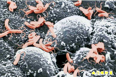幽门螺杆菌 Helicobacter pylori