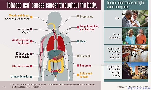 烟草与全身的癌症