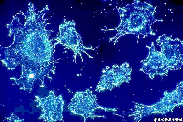研究揭示高剂量维生素C是如何杀死癌细胞