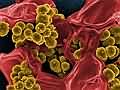 科学家在对耐药菌的个性化抗生素治疗上取得长足进步
