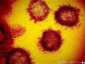 全球新型冠状病毒感染者超过100万人，死亡人数超过5万